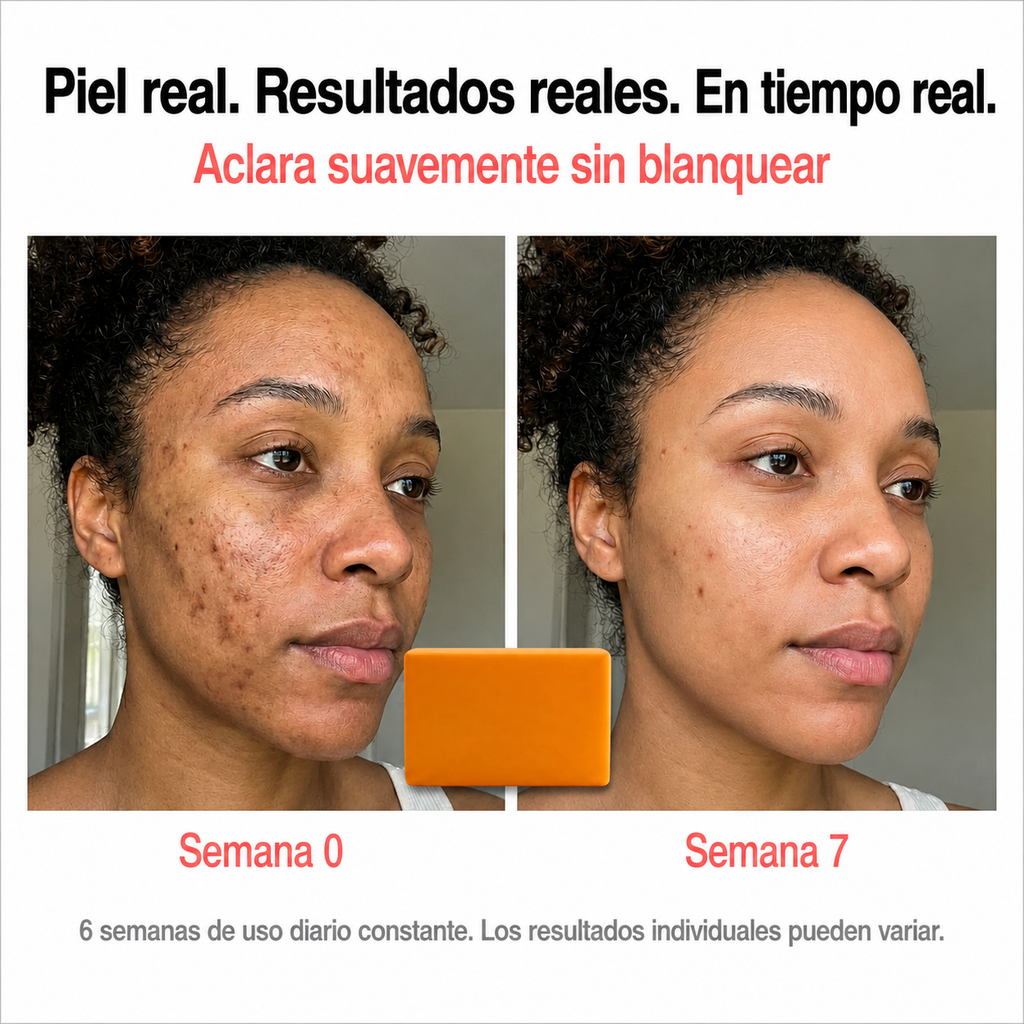 Jabón aclarante de cúrcuma - Quita manchas