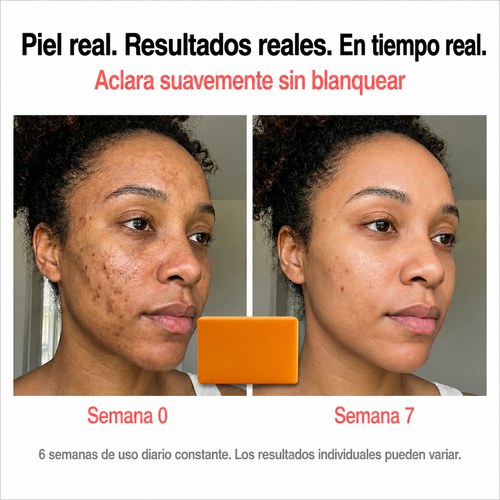Jabón aclarante de cúrcuma - Quita manchas