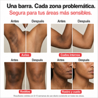 Jabón aclarante de cúrcuma - Quita manchas
